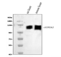 Invitrogen SERCA2 ATPase Polyclonal Antibody 100 &mu;g; Unconjugated:Antibodies,