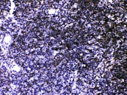 Invitrogen SERCA3 ATPase Polyclonal Antibody 100 &mu;g; Unconjugated:Antibodies,