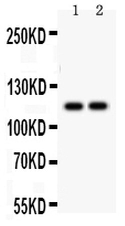 Invitrogen SERCA3 ATPase Polyclonal Antibody 100 &mu;g; Unconjugated:Antibodies,