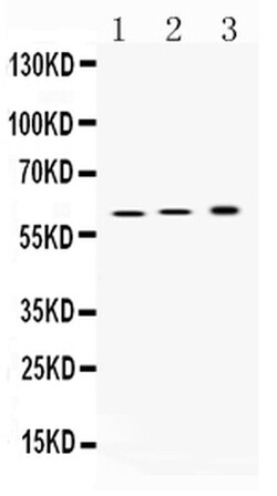 Invitrogen ATP4B Polyclonal Antibody 100 &mu;g; Unconjugated:Antibodies,