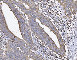 Invitrogen ATP5H Polyclonal Antibody 100 &mu;g; Unconjugated:Antibodies,