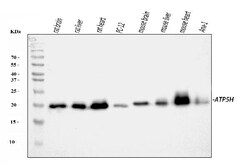 Invitrogen ATP5H Polyclonal Antibody 100 &mu;g; Unconjugated:Antibodies,