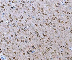 Invitrogen Ataxin 2 Polyclonal Antibody 100 &mu;g; Unconjugated:Antibodies,