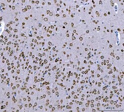 Invitrogen Ataxin 2 Polyclonal Antibody 100 &mu;g; Unconjugated:Antibodies,