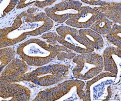 Invitrogen Ataxin 2 Polyclonal Antibody 100 &mu;g; Unconjugated:Antibodies,