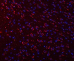 Invitrogen Ataxin 2 Polyclonal Antibody 100 &mu;g; Unconjugated:Antibodies,
