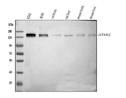 Invitrogen Ataxin 2 Polyclonal Antibody 100 &mu;g; Unconjugated:Antibodies,