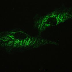 Invitrogen Ataxin 2 Polyclonal Antibody 100 &mu;g; Unconjugated:Antibodies,