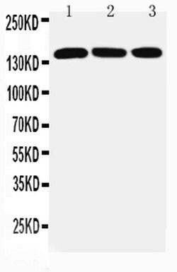 Invitrogen Ataxin 2 Polyclonal Antibody 100 &mu;g; Unconjugated:Antibodies,