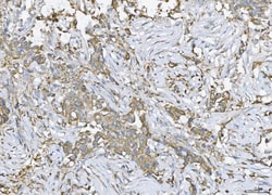 Invitrogen Ataxin 2 Polyclonal Antibody 100 &mu;g; Unconjugated:Antibodies,