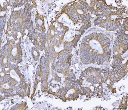Invitrogen Ataxin 2 Polyclonal Antibody 100 &mu;g; Unconjugated:Antibodies,