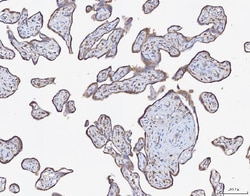 Invitrogen Ataxin 2 Polyclonal Antibody 100 &mu;g; Unconjugated:Antibodies,