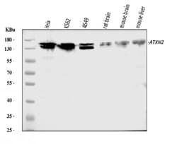 Invitrogen Ataxin 2 Polyclonal Antibody 100 &mu;g; Unconjugated:Antibodies,