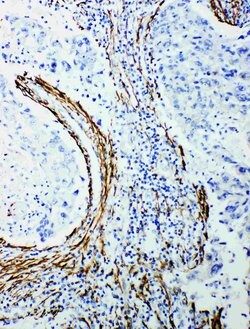 Ataxin 3 Rabbit anti-Human, Mouse, Rat, Polyclonal, Invitrogen 100 &mu;g;