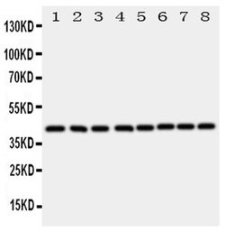 Ataxin 3 Rabbit anti-Human, Mouse, Rat, Polyclonal, Invitrogen 100 &mu;g;