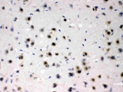 Invitrogen ADC Polyclonal Antibody 100 &mu;g; Unconjugated:Antibodies,