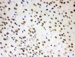 Invitrogen ADC Polyclonal Antibody 100 &mu;g; Unconjugated:Antibodies,