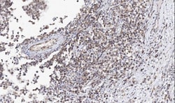 Invitrogen ADC Polyclonal Antibody 100 &mu;g; Unconjugated:Antibodies,
