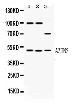 Invitrogen ADC Polyclonal Antibody 100 &mu;g; Unconjugated:Antibodies,