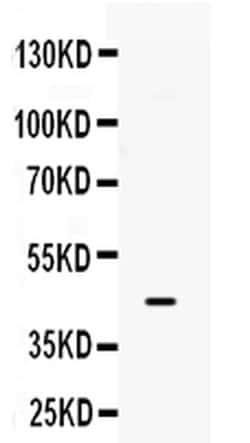 Invitrogen B3GNT8 Polyclonal Antibody 100 &mu;g; Unconjugated:Antibodies,