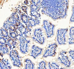 Invitrogen BAG1 Polyclonal Antibody 100 &mu;g; Unconjugated:Antibodies,