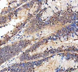 Invitrogen BAG1 Polyclonal Antibody 100 &mu;g; Unconjugated:Antibodies,
