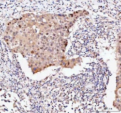 Invitrogen BAG1 Polyclonal Antibody 100 &mu;g; Unconjugated:Antibodies,