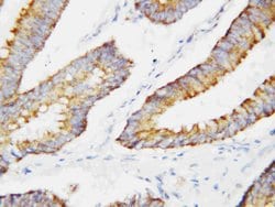 Invitrogen BCAT2 Polyclonal Antibody 100 &mu;g; Unconjugated:Antibodies,