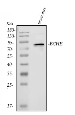 Invitrogen Butyrylcholinesterase Polyclonal Antibody 100 &mu;g | Buy Online | Invitrogen&trade; | Fisher Scientific