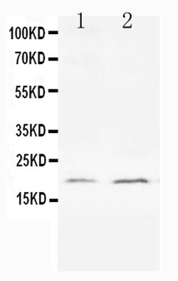 Invitrogen Bcl-XS Polyclonal Antibody 100 &mu;g | Buy Online | Invitrogen&trade; | Fisher Scientific