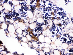 Invitrogen Osteocalcin Polyclonal Antibody 100 &mu;g | Buy Online | Invitrogen&trade; | Fisher Scientific