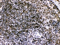 Invitrogen BIK Polyclonal Antibody 100 &mu;g | Buy Online | Invitrogen&trade; | Fisher Scientific