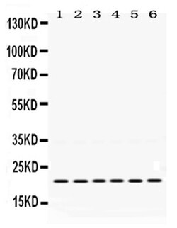 Invitrogen BIK Polyclonal Antibody 100 &mu;g | Buy Online | Invitrogen&trade; | Fisher Scientific