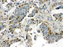 Invitrogen BMP5 Polyclonal Antibody 100 &mu;g; Unconjugated:Antibodies,