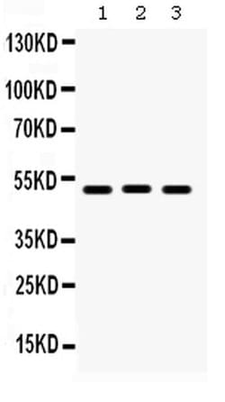 Invitrogen BMP5 Polyclonal Antibody 100 &mu;g; Unconjugated:Antibodies,