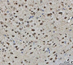 Invitrogen BRCA1 Polyclonal Antibody 100 &mu;g; Unconjugated:Antibodies,