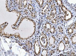Invitrogen BRCA1 Polyclonal Antibody 100 &mu;g; Unconjugated:Antibodies,