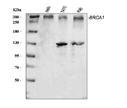 Invitrogen BRCA1 Polyclonal Antibody 100 &mu;g; Unconjugated:Antibodies,