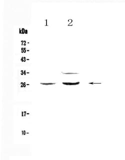 Invitrogen betacellulin Polyclonal Antibody 100 &mu;g | Buy Online | Invitrogen&trade; | Fisher Scientific
