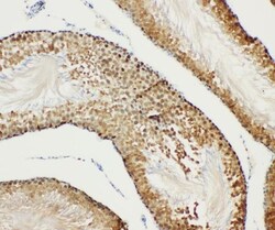 Invitrogen Bub3 Polyclonal Antibody 100 &mu;g; Unconjugated:Antibodies,