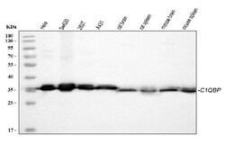 Invitrogen C1QBP Polyclonal Antibody 100 &mu;g | Buy Online | Invitrogen&trade; | Fisher Scientific