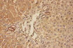 Invitrogen Complement C5a Polyclonal Antibody 100 &mu;g | Buy Online | Invitrogen&trade; | Fisher Scientific