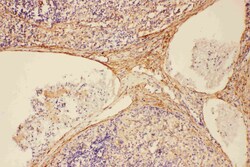 Invitrogen Complement C5a Polyclonal Antibody 100 &mu;g | Buy Online | Invitrogen&trade; | Fisher Scientific