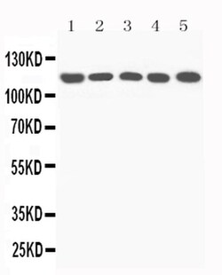 Invitrogen Complement C5a Polyclonal Antibody 100 &mu;g | Buy Online | Invitrogen&trade; | Fisher Scientific
