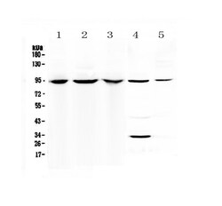 Invitrogen C7 Polyclonal Antibody 100 &mu;g | Buy Online | Invitrogen&trade; | Fisher Scientific