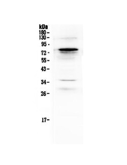 Invitrogen Complement C9 Polyclonal Antibody 100 &mu;g | Buy Online | Invitrogen&trade; | Fisher Scientific