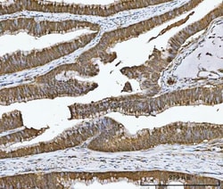 Invitrogen Carbonic Anhydrase I Polyclonal Antibody 100 &mu;g; Unconjugated:Antibodies,