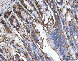 Invitrogen Carbonic Anhydrase I Polyclonal Antibody 100 &mu;g; Unconjugated:Antibodies,