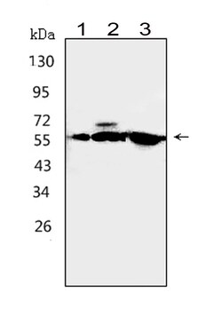 Invitrogen CaMKK alpha Polyclonal Antibody 100 &mu;g; Unconjugated:Antibodies,