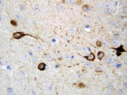 Invitrogen CAMKK2 Polyclonal Antibody 100 &mu;g; Unconjugated:Antibodies,
